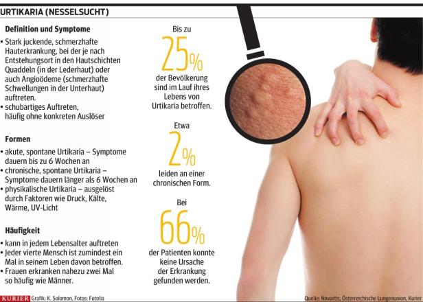 Chronischer Juckreiz: Viele sind betroffen, nur wenige kennen den Auslöser