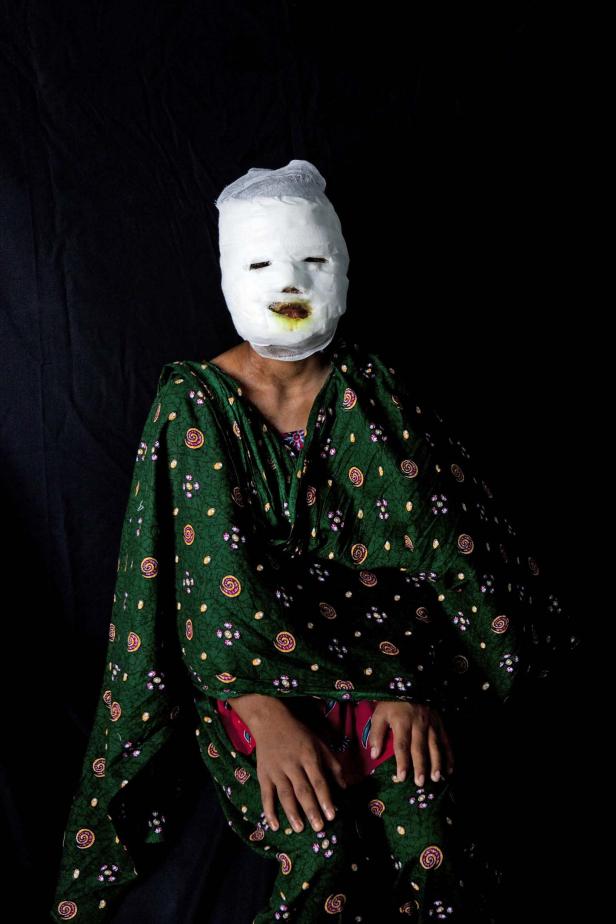 Eine Person mit bandagiertem Gesicht und einem grün gemusterten Kleid vor schwarzem Hintergrund.