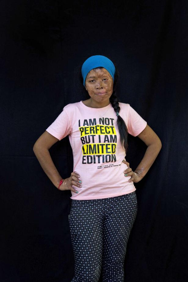 Eine Frau mit einem T-Shirt mit der Aufschrift „I am not perfect but I am limited edition“.