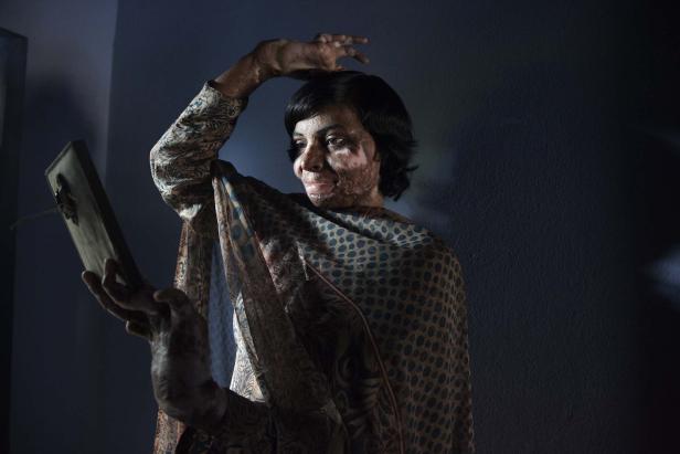 Eine Frau mit Brandnarben betrachtet sich in einem Spiegel.