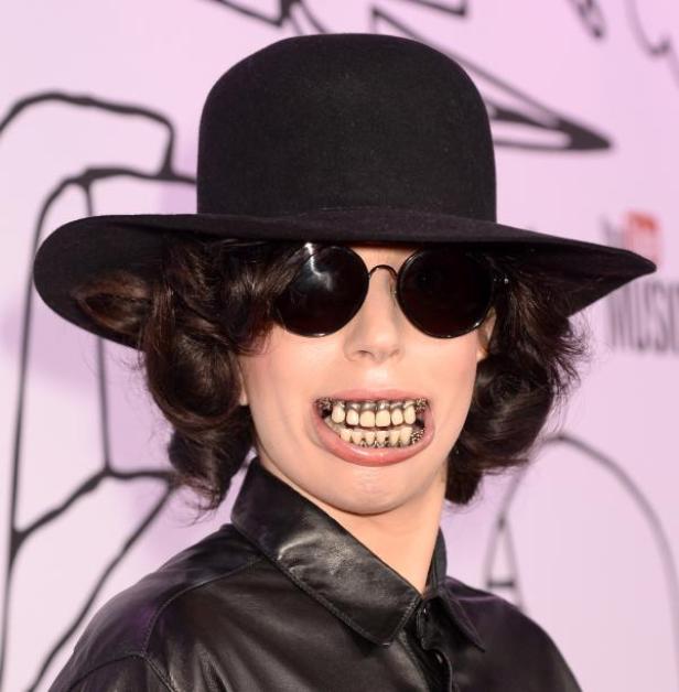 Lady Gaga mit Hut, runder Sonnenbrille und auffälligem Zahnschmuck.