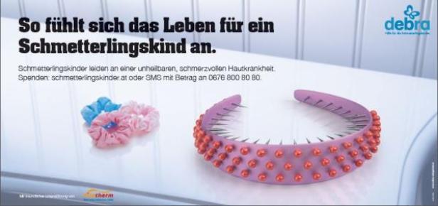 Ein Stirnband mit nach innen gerichteten Stacheln und zwei Haargummis symbolisieren die Hautkrankheit von Schmetterlingskindern.