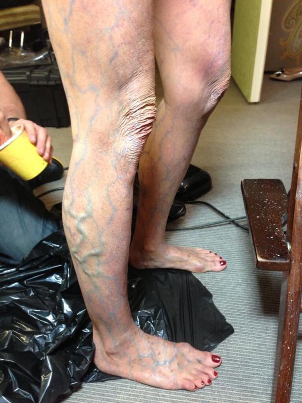 Die Beine einer Person sind mit blauen Adern bemalt.