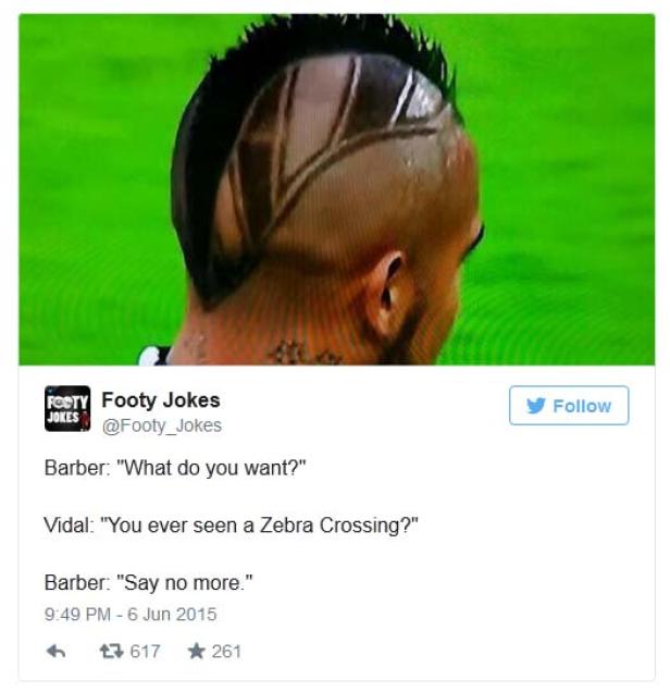 Ein Mann mit einem ungewöhnlichen Haarschnitt, der an einen Zebrastreifen erinnert.