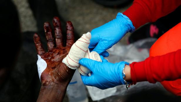 An African migrant is treated for injuries after c