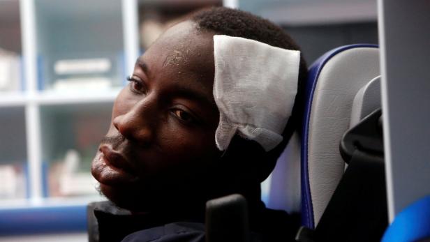 An African migrant is treated for injuries in an a