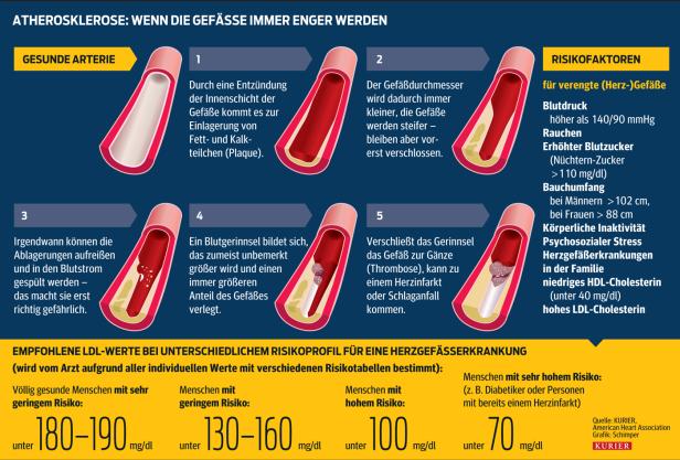 Ist das Cholesterinsenken sinnlos?