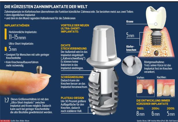 Mit Biss: „Ich kann wieder Schnitzel essen“