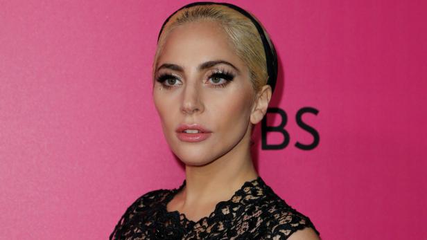 Beauty-Eingriffe: Lady Gaga verändert sich immer mehr