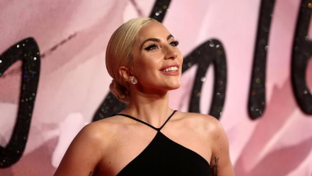 Beauty-Eingriffe: Lady Gaga verändert sich immer mehr