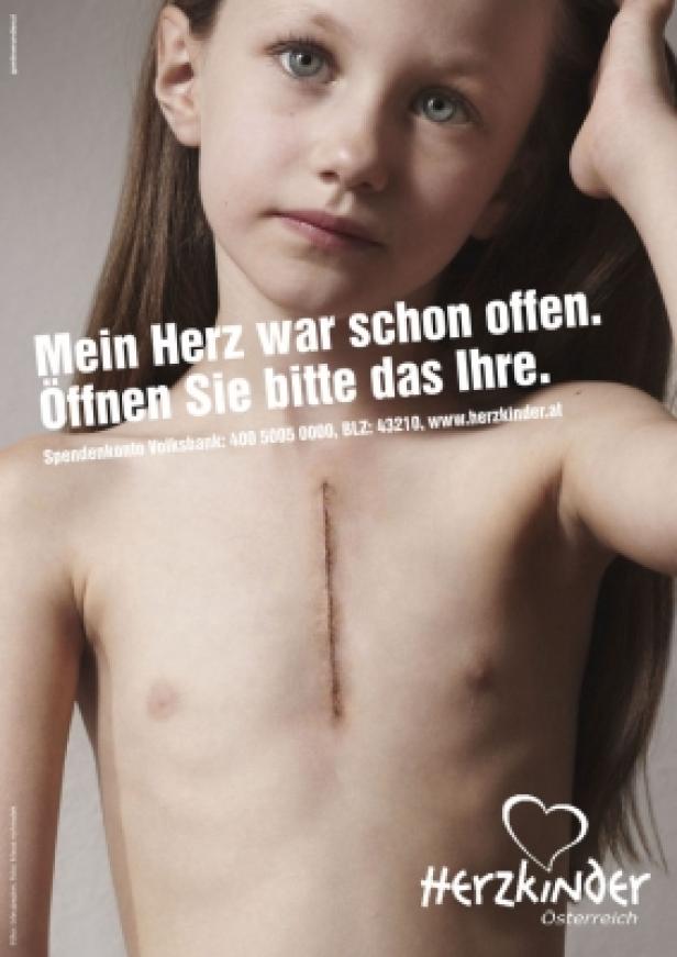 Ein Mädchen mit einer Narbe auf der Brust wirbt für die Organisation Herzkinder Österreich.