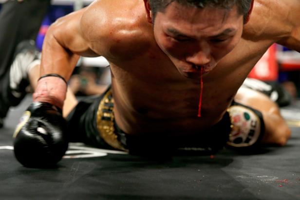 Ein blutender Boxer liegt am Boden des Rings.