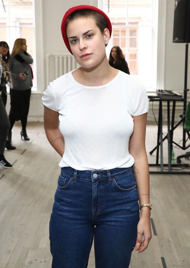 Im Februar wirkten Tallulahs Lippen noch wesentlich schmaler. XL-Lippen: War Tallulah Willis beim Beauty-Doc?
