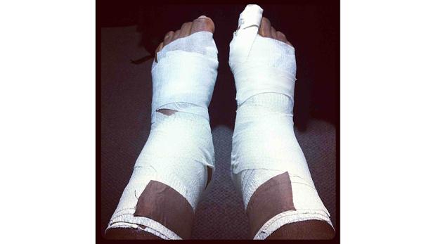 Zwei bandagierte Füße sind zu sehen.