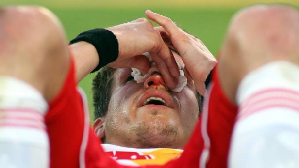 Ein verletzter Sportler liegt mit blutiger Nase auf dem Rücken.