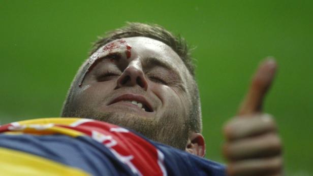 Ein verletzter Mann mit blutender Wunde am Kopf zeigt den Daumen nach oben.