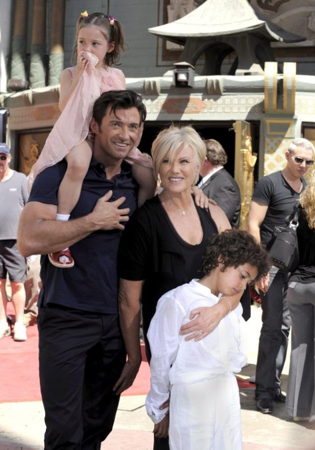 Hugh Jackman: Schock-Diagnose Krebs