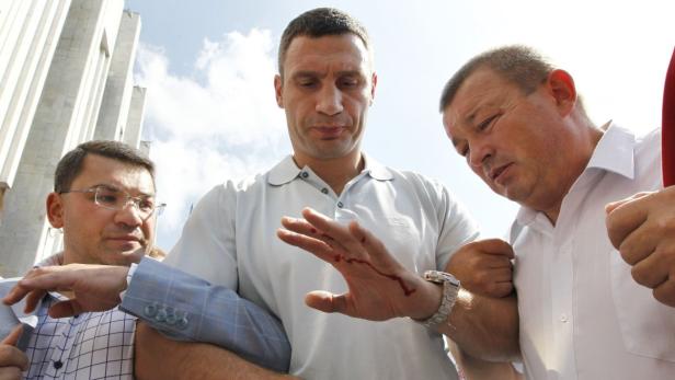 Vitali Klitschko zeigt seine blutende Hand, während zwei Männer ihn stützen.