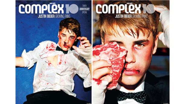 Zwei Cover des Complex Magazins mit einem verletzten Justin Bieber.