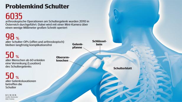 Mit Vollgas zur kaputten Schulter