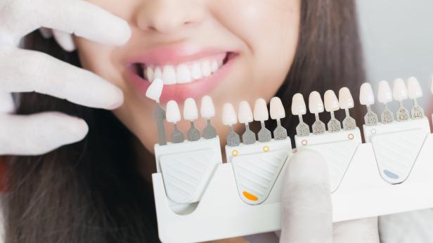 Weiße Zähne: Wie schädlich sind Whitening-Methoden?