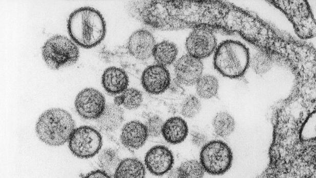 Tödlicher Virus in US-Nationalpark