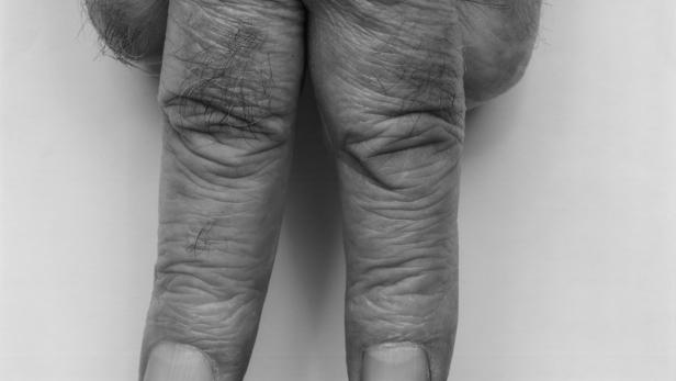 Nahaufnahme von zwei faltigen, behaarten Fingern vor einem neutralen Hintergrund.