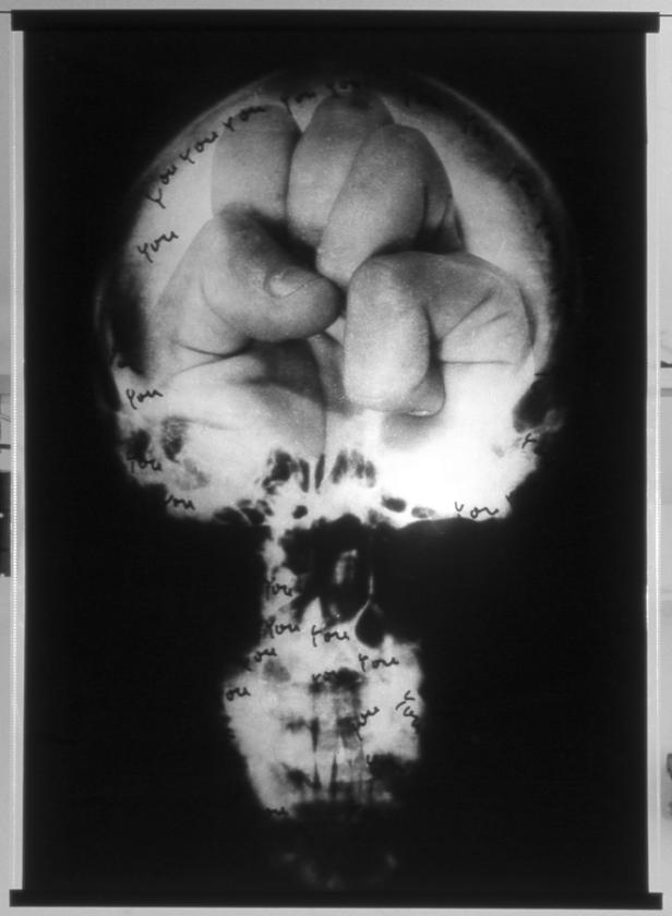 Eine Röntgenaufnahme zeigt eine Faust im Schädel, beschriftet mit dem Wort „You“.