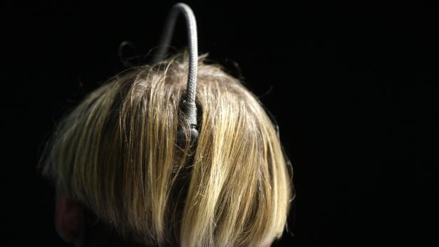 The antenna permanently attached to the skull of a