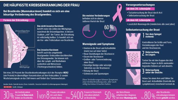 Neue Therapie-Chancen für Brustkrebspatientinnen