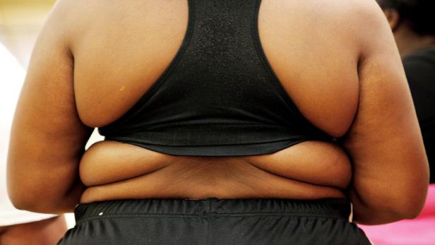 Forscher alarmieren: Jeder dritte Mensch ist übergewichtig