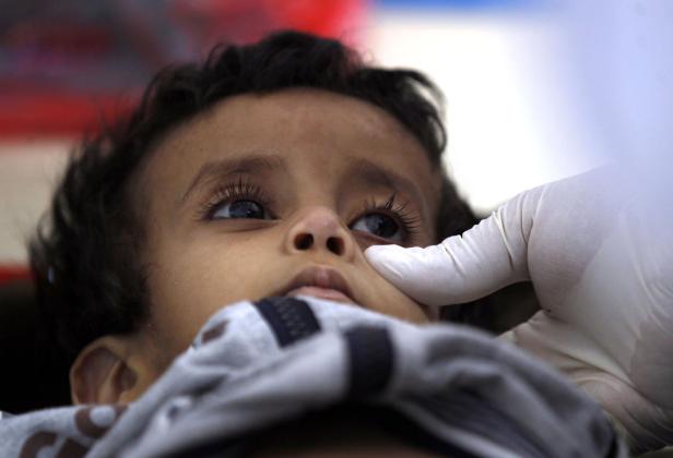 Jemen stirbt den hässlichen Tod