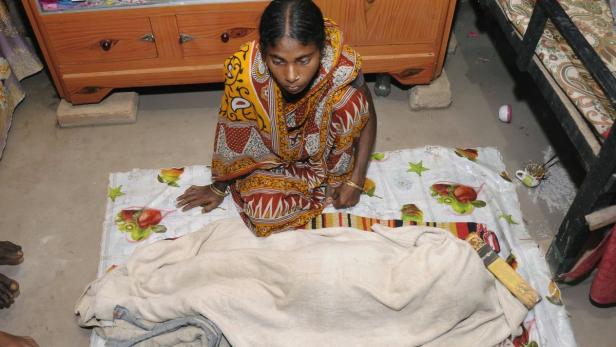 Indien: Mädchen mit Wasserkopf gestorben