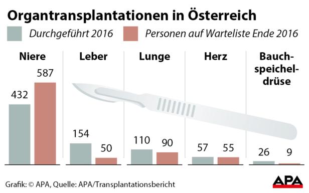 Transplantationsbericht: Mehr Organspender in Österreich