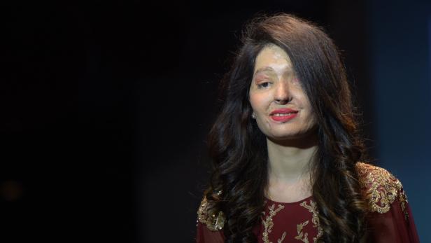 Modenschau mit Opfern von Säureangriffen in Indien