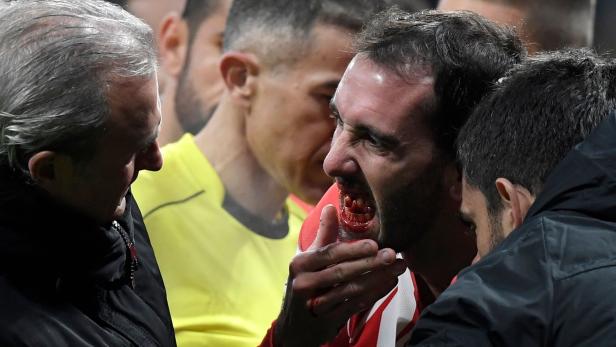 Atletico-Star Godin verliert drei Zähne