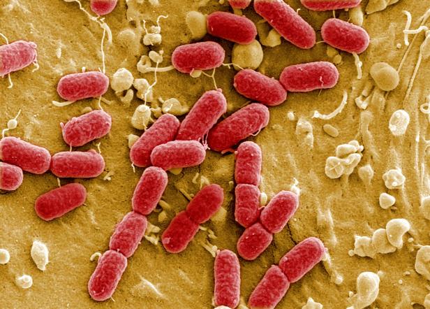 Ehec-Erreger aus Römersalat: Einer von 120 Infizierten in den USA gestorben