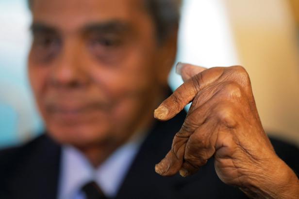 Nach 66 Jahren abgeschnitten: Längste Fingernägel zwei Meter lang