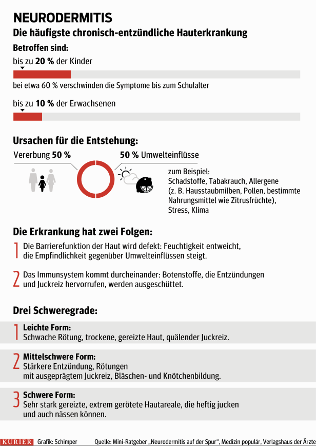 Neurodermitis: Zahl der Patienten steigt stark an