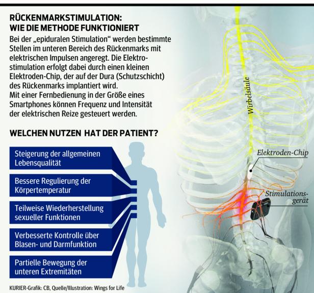 Querschnittgelähmter konnte mit Hilfe 102 Meter gehen