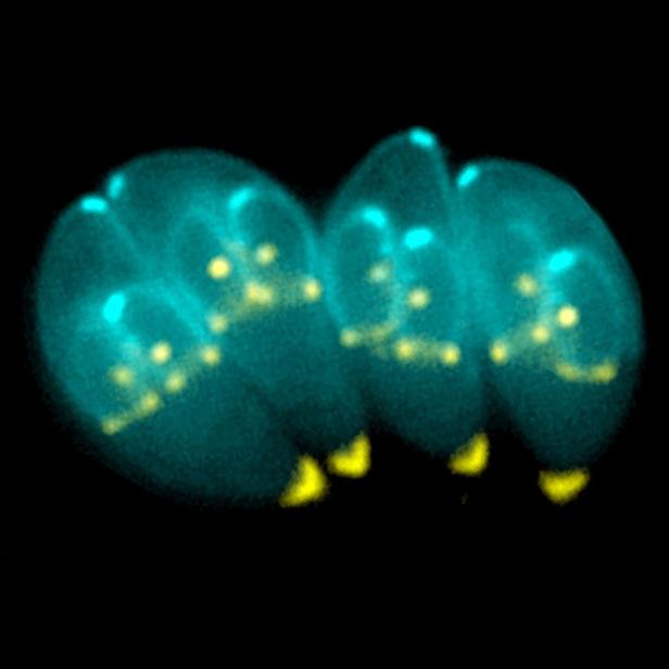 Verändert Toxoplasmose das Verhalten?