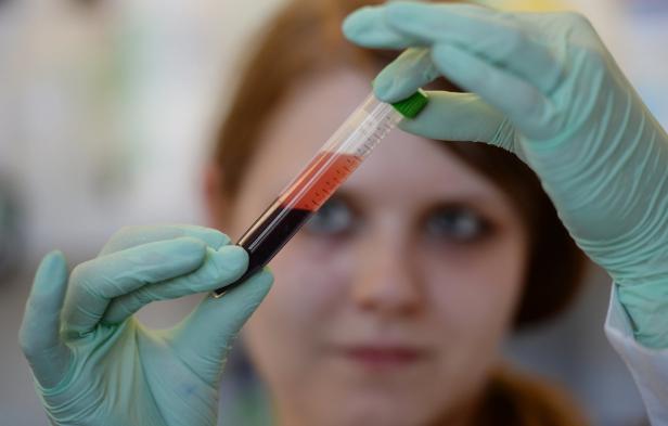 Laboranalysen: Der immer tiefere Blick ins Blut