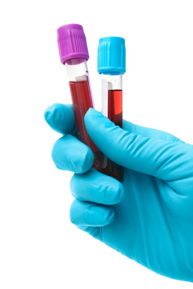 Laboranalysen: Der immer tiefere Blick ins Blut