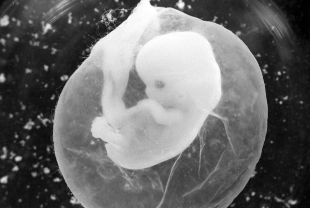 Ein Embryo in einer transparenten Fruchtblase vor dunklem Hintergrund.