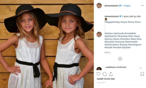 Instagram-Hype um die schönsten Zwillinge der Welt