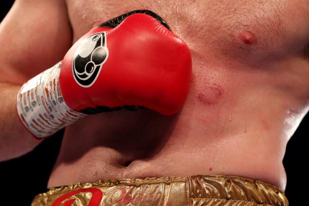 Gegner in Bauch gebissen: Boxer Kash Ali suspendiert