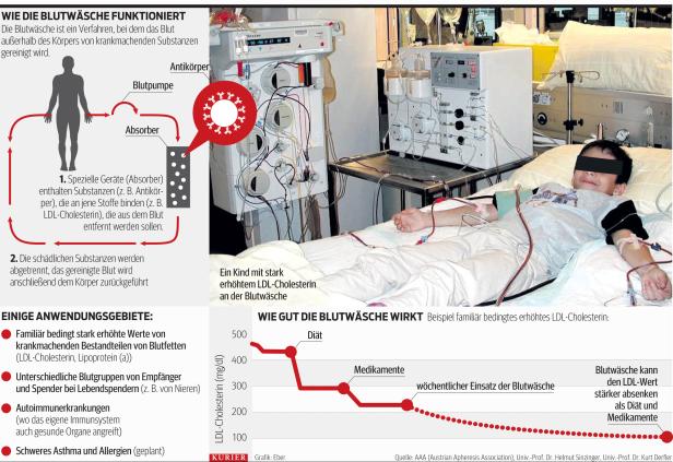 Wenn schädliche Stoffe aus dem Blut gewaschen werden