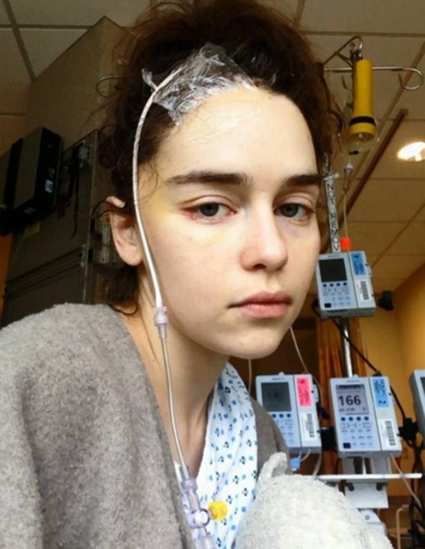 Emilia Clarke über ihre Hirn-Operationen: "Teil meines Gehirns starb ab"