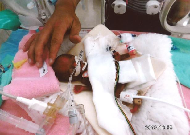 JAPAN-HEALTH-INFANTS