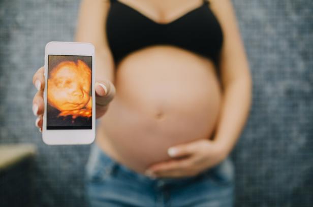 Ultraschall: Der gefährliche Blick aufs Baby?